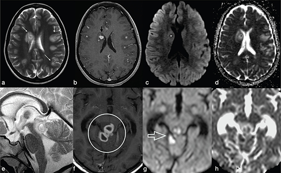 Fig 14